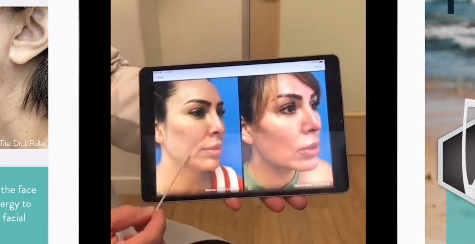 KELLY DODD’S FACETITE JOURNEY