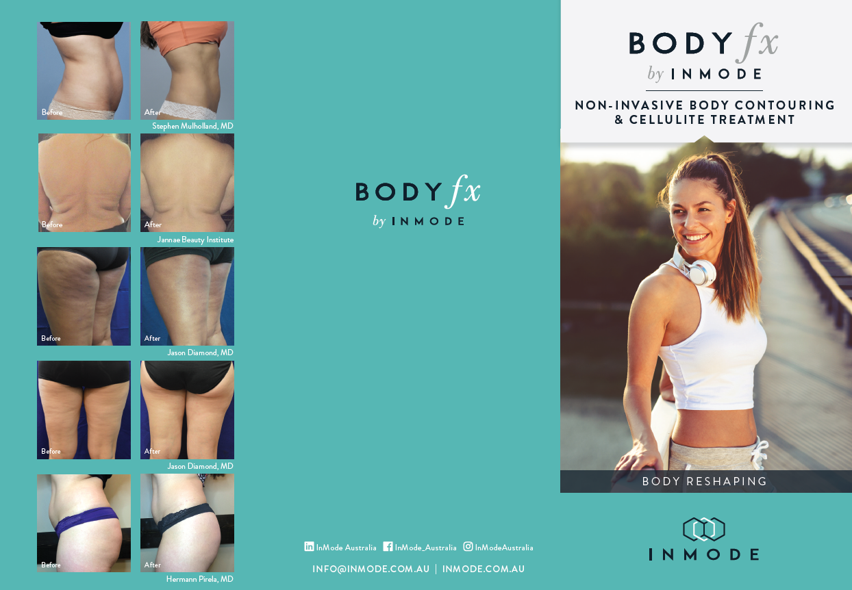 BodyFX Patient Brochures (English) x 125