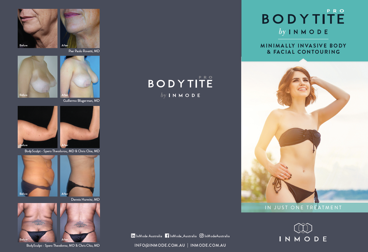 BodyTitePro Patient Brochures (English) x 125