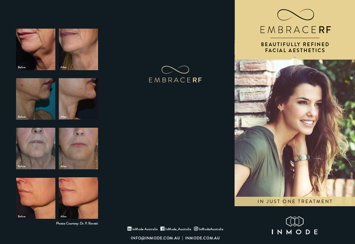 EmbraceRF Patient Brochure (English) x 125