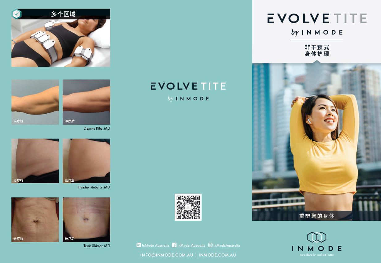 Evolve TITE Patient Brochure (Chinese) x 125