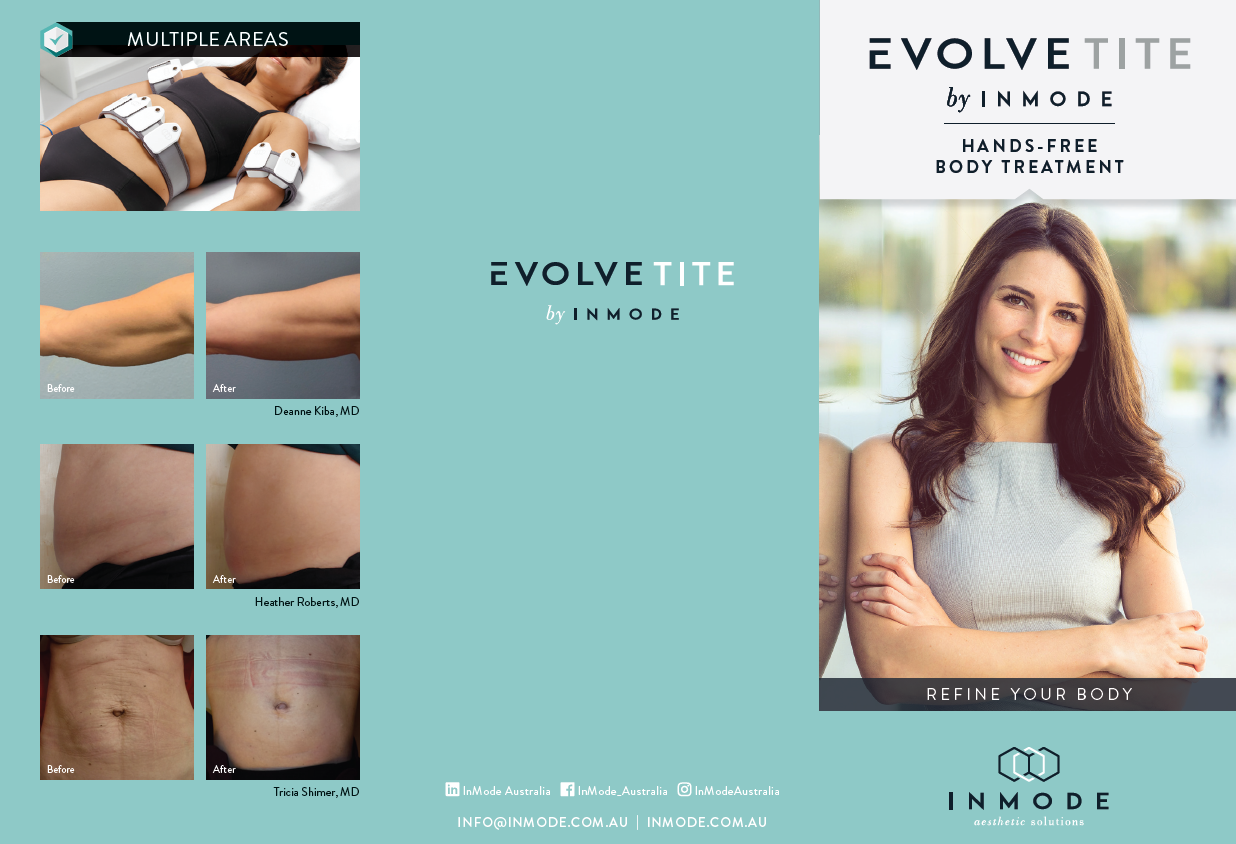 Evolve TITE Patient Brochure (English) x 125