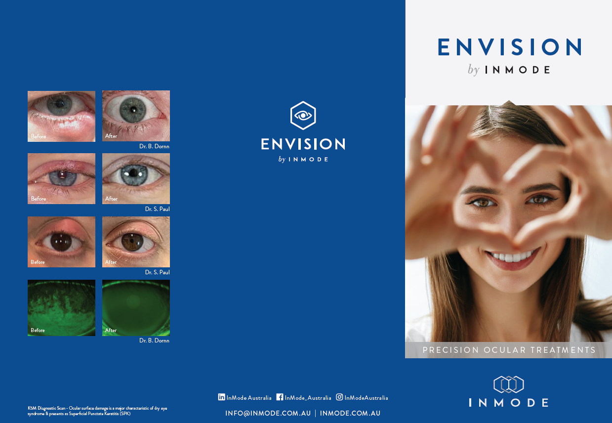 Envision Patient Brochure