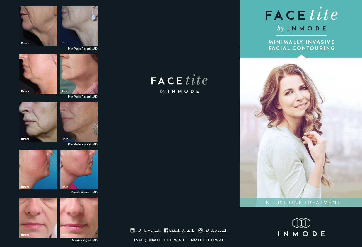 Facetite Patient Brochure (English) x 125