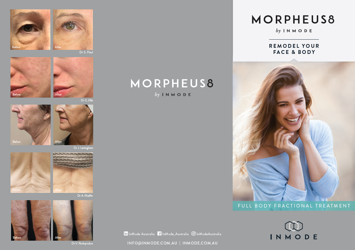 Morpheus8 Patient Brochure (English) x 125