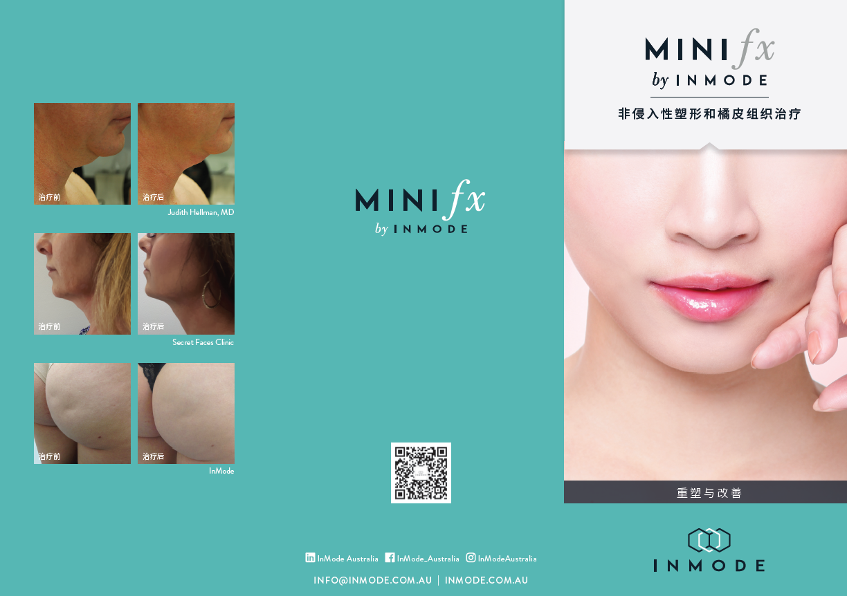 MiniFX Patient Brochure (Chinese) x 125