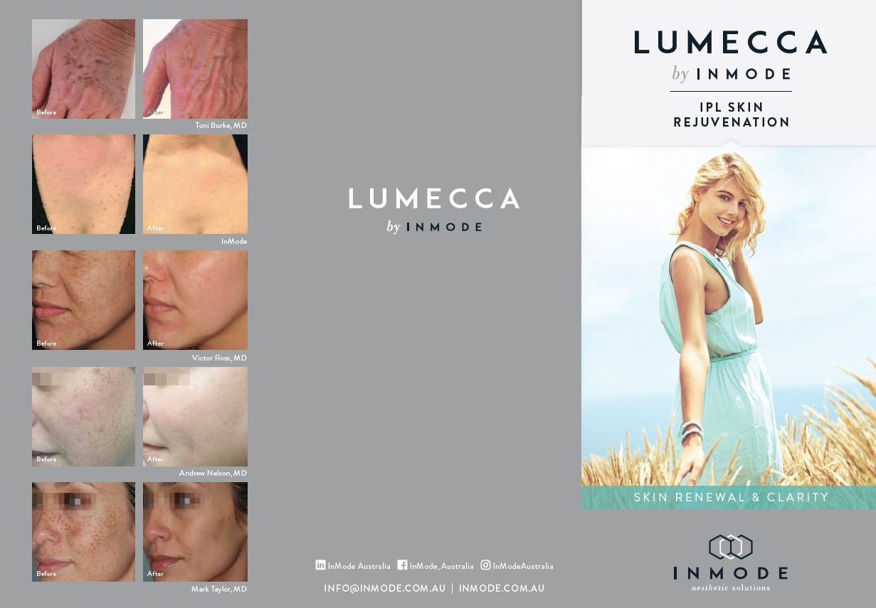 Lumecca Patient Brochure (English) x 125